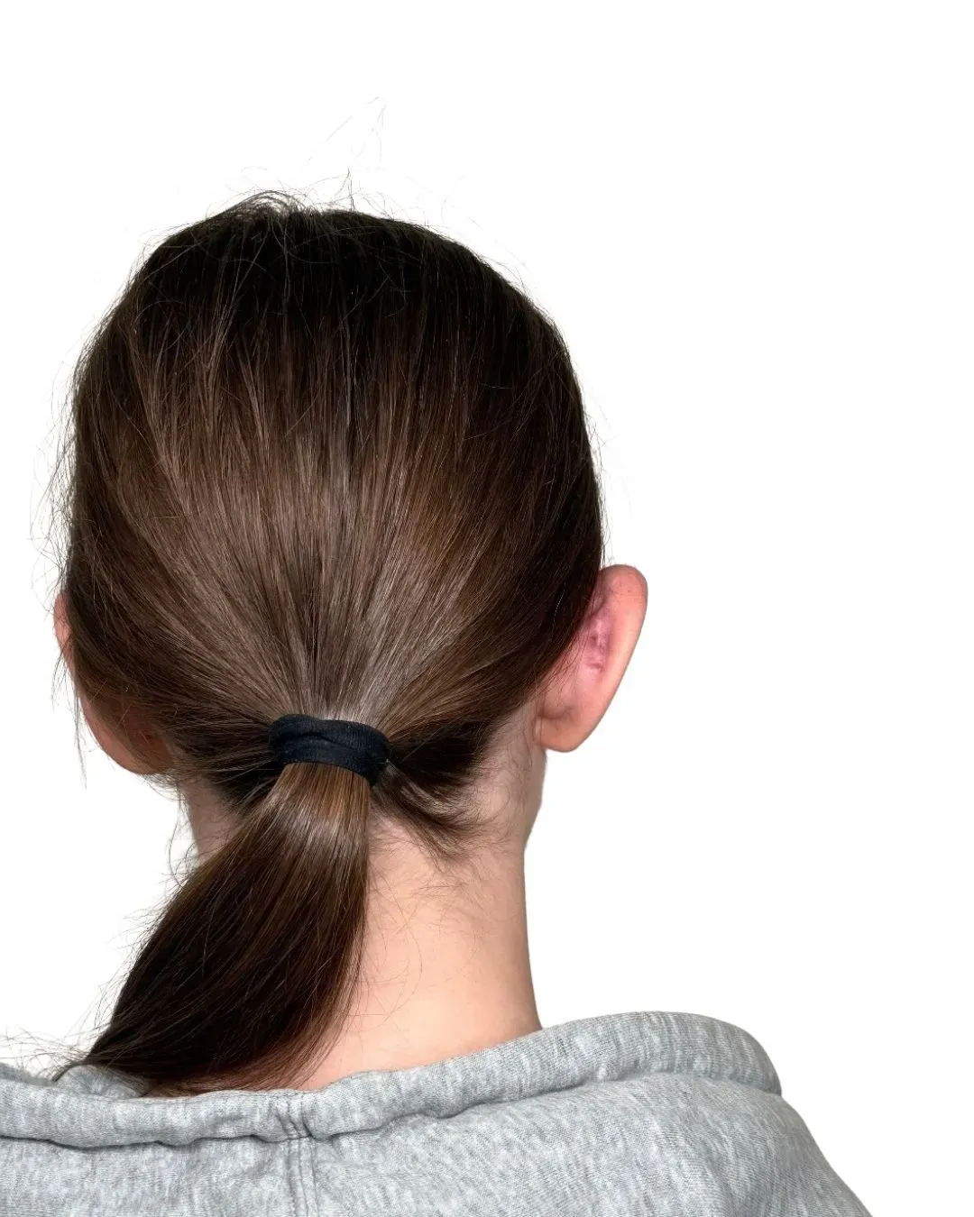 Przed zabiegiem — otoplastyka, ujęcie z tyłu