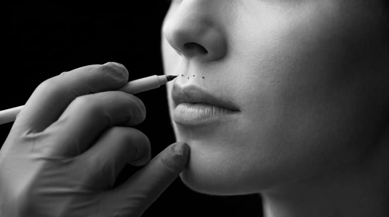 Planowanie lip liftu — dłoń w rękawiczce zaznacza markerem punkty pod nosem
